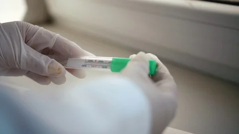 Use of a mercury thermometer Stock Footage 126417026