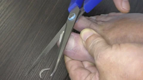 Use scissors to cut the overgrown toenails. Stock Footage 159055801