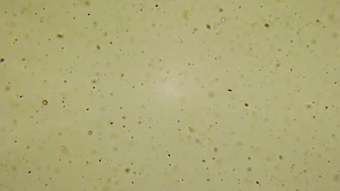 Used motor oil under a microscope. Optical zoom limit. The smallest particles Stock Footage 163262987