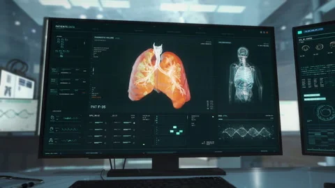 Using Advanced Computer Software In Laboratory To Make Covid-19 Diagnosis Stock Footage 268258956