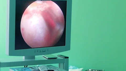 Using an endoscope, the doctor performs an operation on the face of a person Video stock 72565600