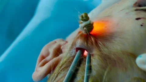 Using a medical video endoscope with a scraper, a doctor lifts the skin on a per Stock Footage 123575442