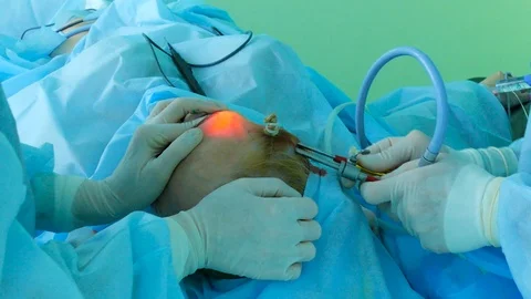 Using a medical video endoscope with a scraper, a doctor raises the skin on a pe Stock-Footage 123575493
