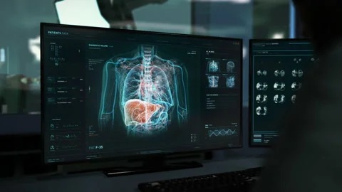 Using Microscopic Scan Ui To Diagnose Dangerous Cancer Illness In Lungs Stock Footage 179875499