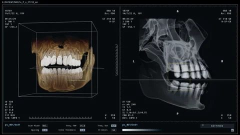 Using Modern computer program deals with the dental stomatology examination Stock Footage 271597569