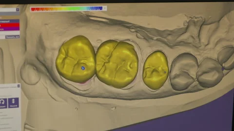 Using the modern dentistry computer program to model the artificial teeth Stock Footage 243516027