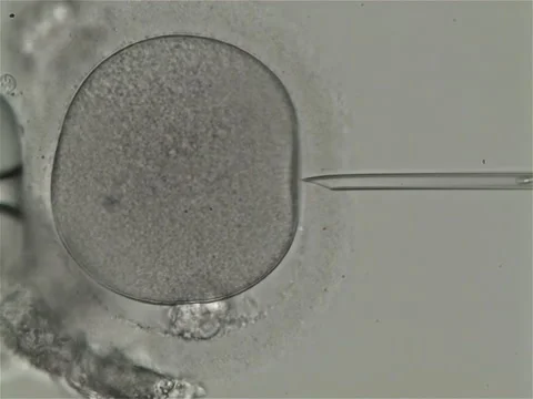 Using a needle for the medical IVF Procedure on a patient under a microscope Stock Footage 305946477