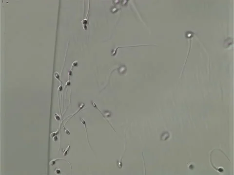 Using scientific microscopic equipment to analyze the slow-moving sperm cells Stock Footage 257690934