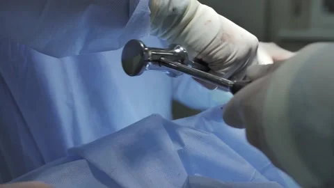 Using steel surgery instruments while performing rhinoplasty Stock-Footage 150564898