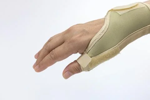 Using Thumb Splints to treat De Quervain's Tenosynovitis 스톡 사진
