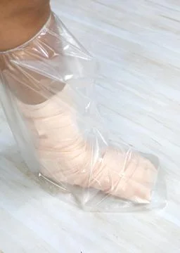 Using a Waterproof Cast Cover Stock Photos