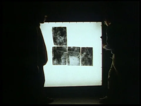 Using x-ray to determine a picture, UK 1992 Video stock 136687237