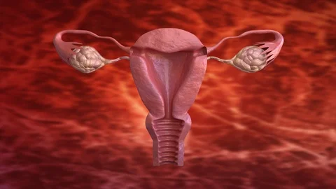 Uterine fibroid are benign solid tumors formed by muscle tissue. Its size can Stock Footage 110772309