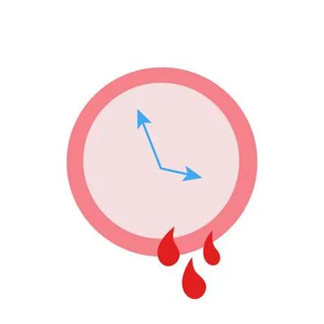 Uterus Polyps Stock Illustration