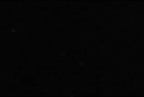 Vaccine Reaction 動画素材 103802