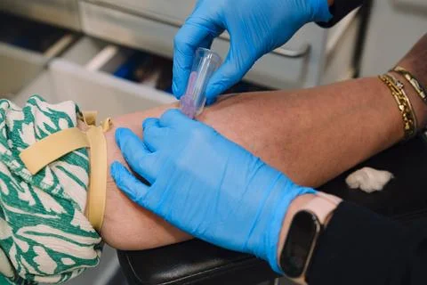Vacutainer Needle Inserted in Patient Arm During Blood Collection Procedure. Stock Photos