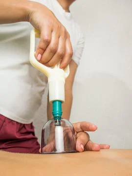 Vacuum cupping massage process Stock Photos