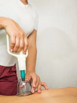 Vacuum cupping massage process Stock Photos