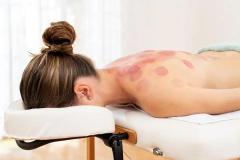 Vacuum Cupping Therapy Background. Stock Photos