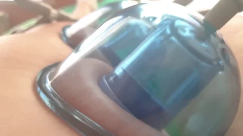 Vacuum massage close up, slow motion 스톡 동영상 109502354