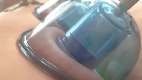 Vacuum massage close up, slow motion Video stock 109546805