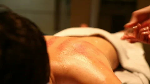 Vacuum Massage Stock Footage 373581