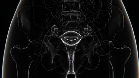 Vaginal Candidiasis Indication X-ray in HD video | Vaginal yeast infection in Vidéo 300682599