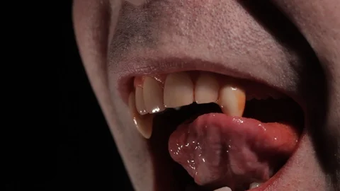 Vampire Teeth Videos, Download The BEST Free 4k Stock Video