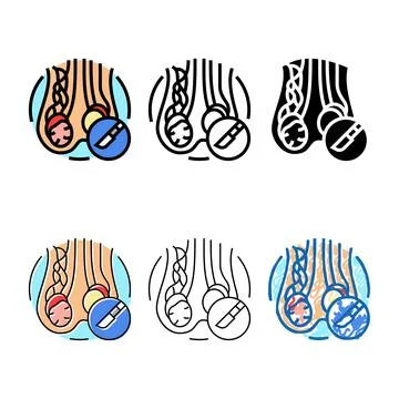 Varicocelectomy modern surgery color icon vector Stock Illustration