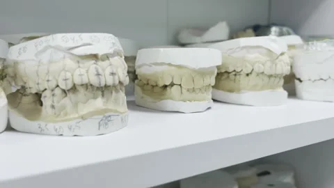 Various dental casts of jaw teeth, close up. Plaster teeth impression for Stock Footage 255502183