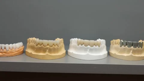 Various jaw models in a dental laboratory Stock Footage 330176527