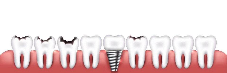 Various teeth conditions Stock Illustration