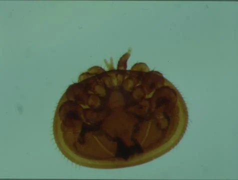 Varroa bee mite under the microscope Stock Photos