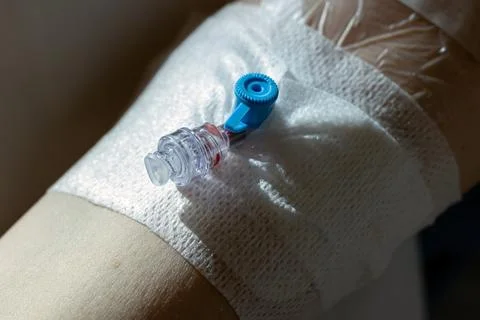 Vascular Access is Opened Patient Stock Photos