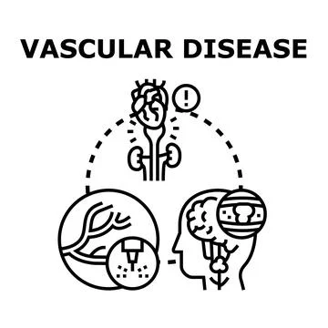 Vascular disease concept impacting human organs Stock Illustration