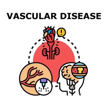 Vascular disease concept impacting human organs Stock Illustration