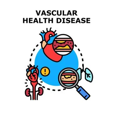 Vascular disease diagnosing process with heart and lungs Stock Illustration