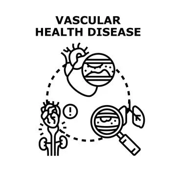 Vascular disease diagnosing process with heart and lungs Stock Illustration