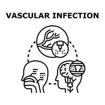 Vascular infection disease attacking human body concept Stock Illustration