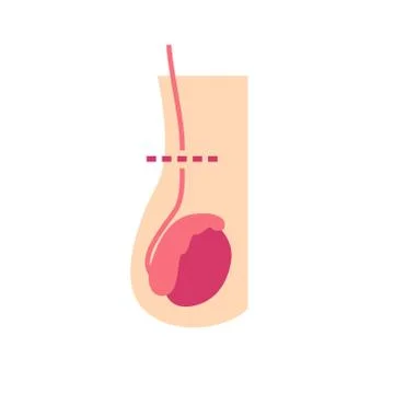 Vasectomy flat icon, vector illustration Stock Illustration