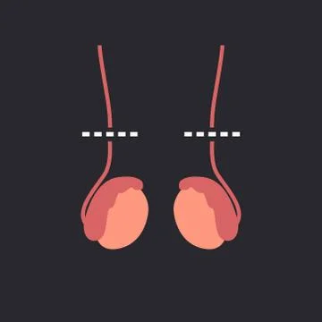 Vasectomy flat icon, vector illustration Stock Illustration