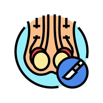 Vasectomy surgery color icon vector illustration Stock Illustration