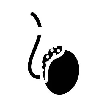 Vasectomy surgery glyph icon vector illustration Stock Illustration