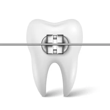Vector 3d Tooth Braces Orthodontic Bracket. Dental Tooth with Metal Bracket and Stock Illustration
