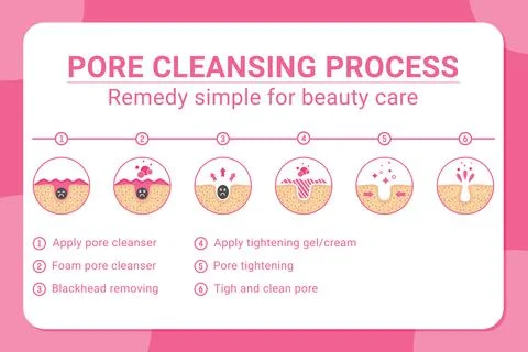 Vector banner 6 tips for blackheads removing and pore cleansing process イラスト素材
