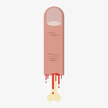 Vector chopped bleeding finger with bone inside Illustrazione stock