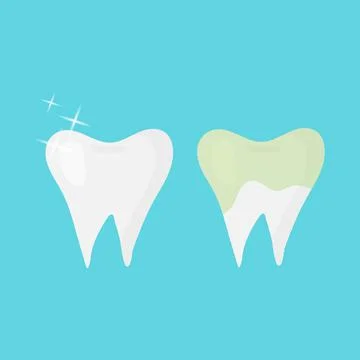 Vector clean and dirty tooth concept in flat style Stock Illustration