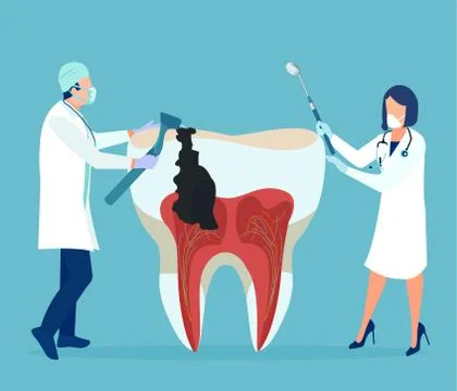 Vector of a dentist and his assistant treating unhealthy tooth with decay Stock Illustration