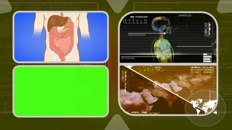 Vector Digestion - Analysis in software - examination - background yellow 02. Stock Footage 62467366