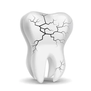 Vector drawn teeth, dental disease. Isolated on white background. Illustrazione stock